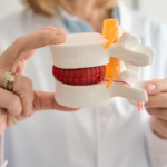 “Hernia de disco cuándo necesita cirugía"