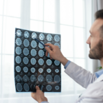 “Neurocirugía mínimamente invasiva ventajas y recuperación”