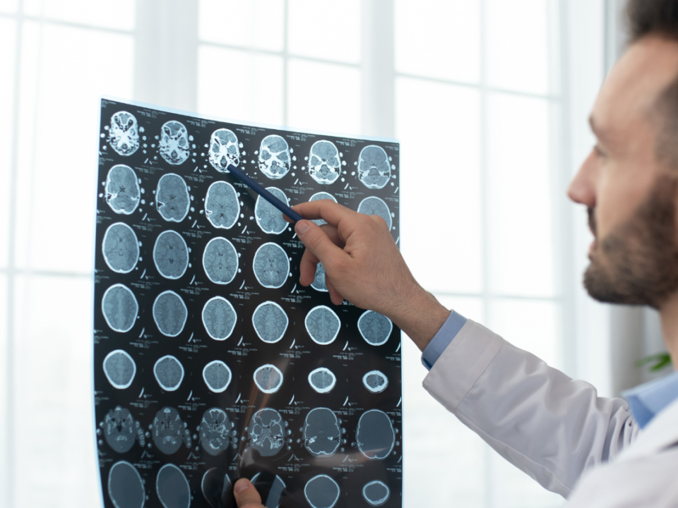 “Neurocirugía mínimamente invasiva ventajas y recuperación”