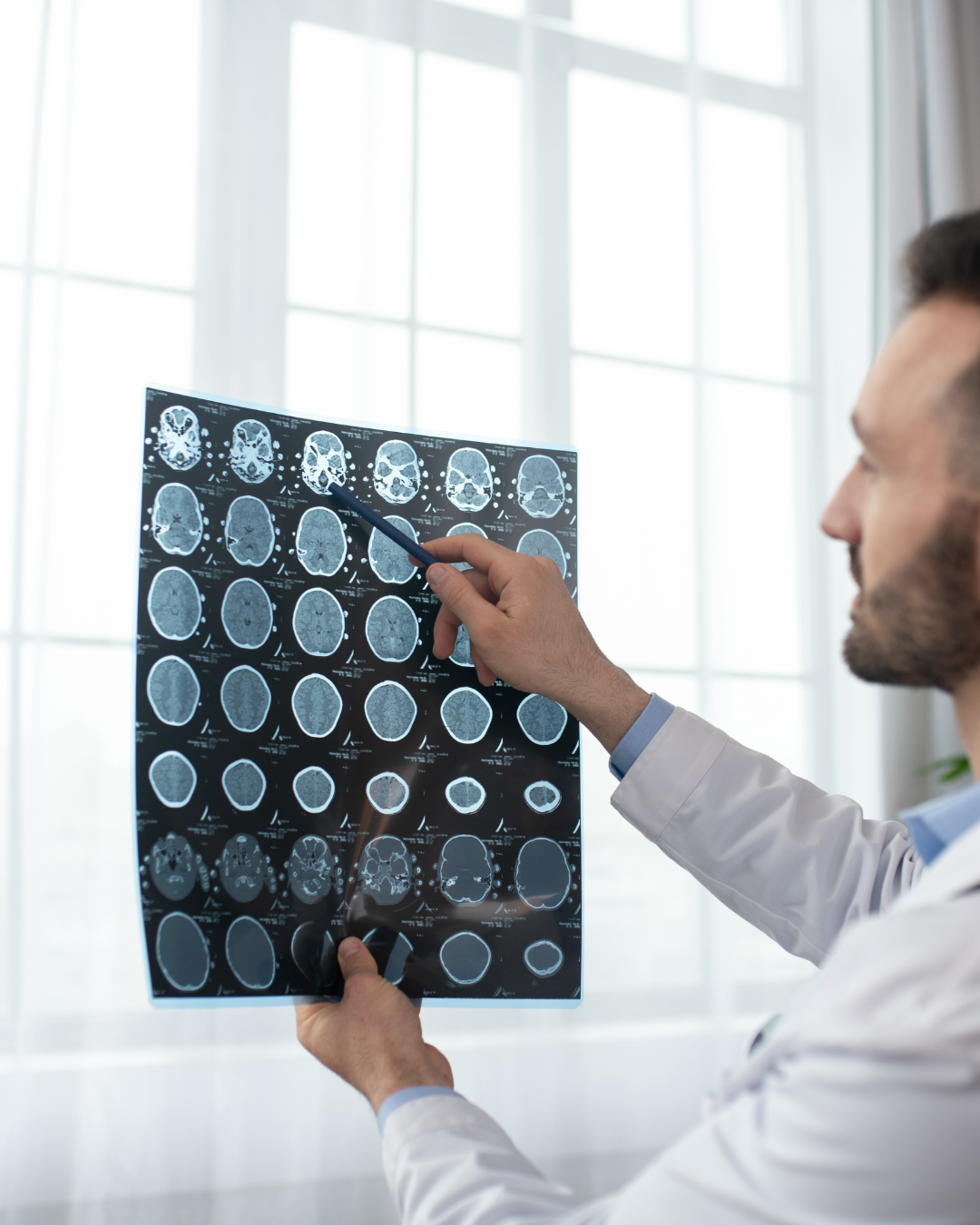 “Neurocirugía mínimamente invasiva ventajas y recuperación”