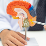 “Tumor cerebral síntomas y tratamiento quirúrgico”