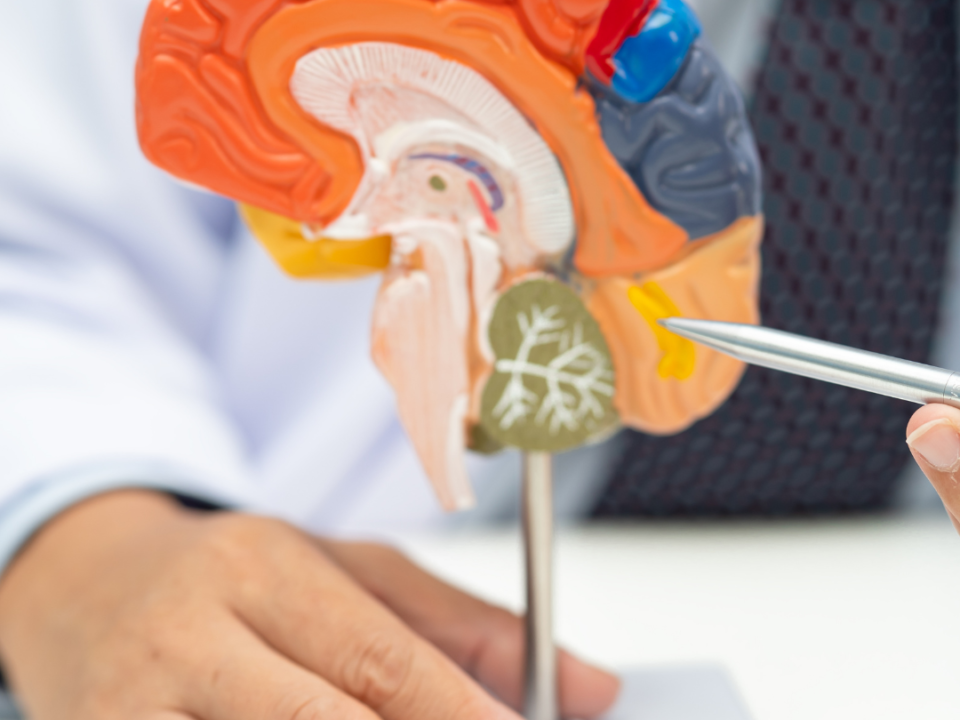 “Tumor cerebral síntomas y tratamiento quirúrgico”