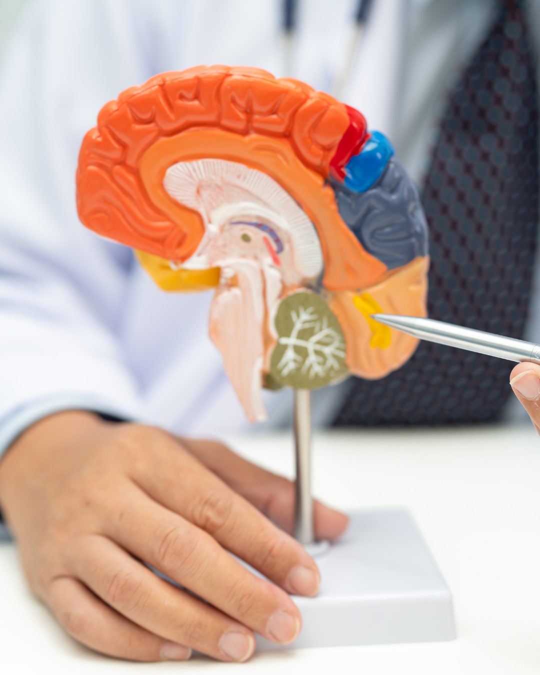 “Tumor cerebral síntomas y tratamiento quirúrgico”