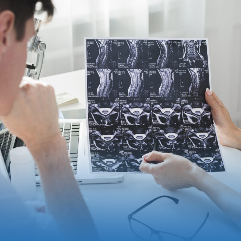 tratamiento de tumores en columna