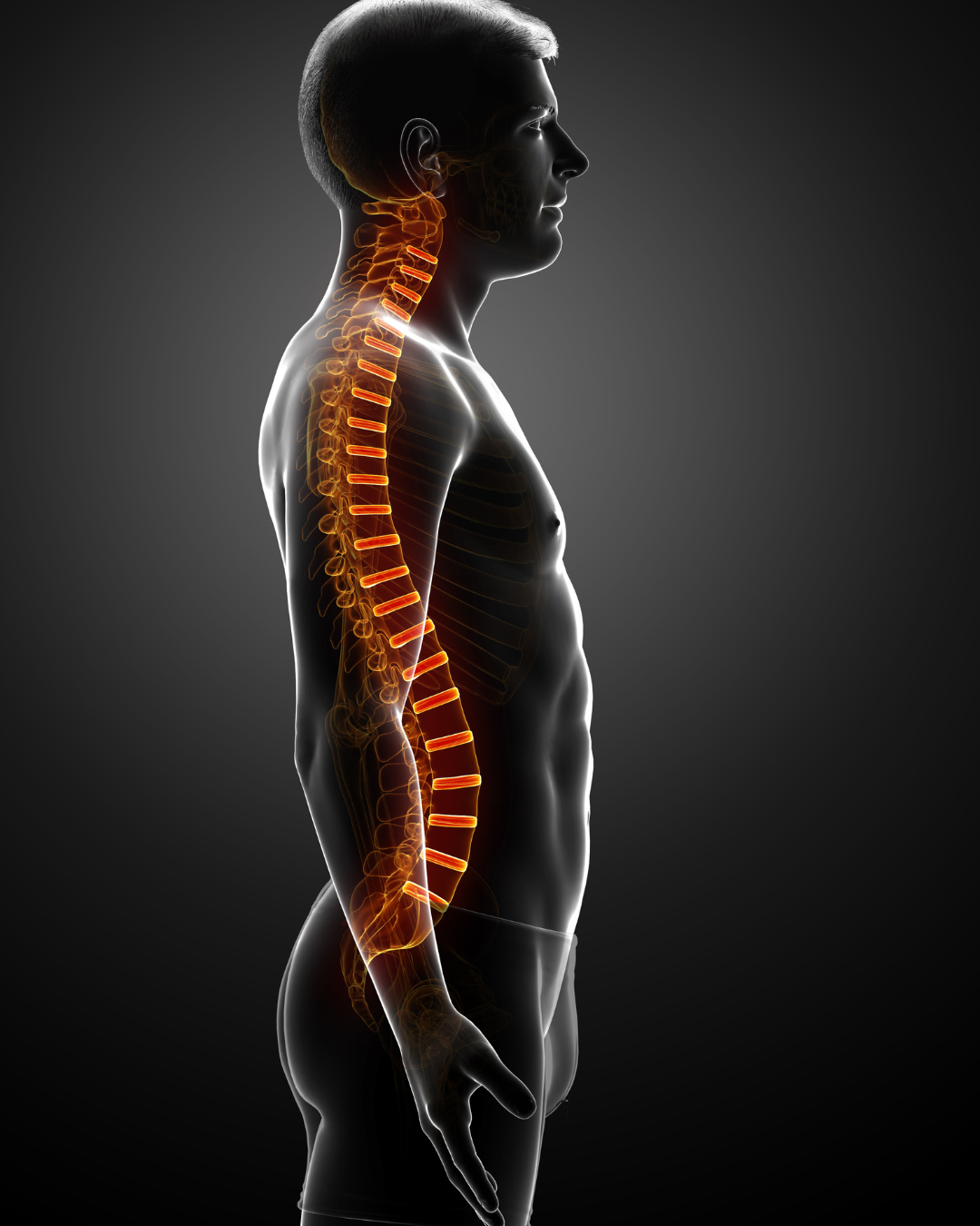 vertebroplastia Guadalajara