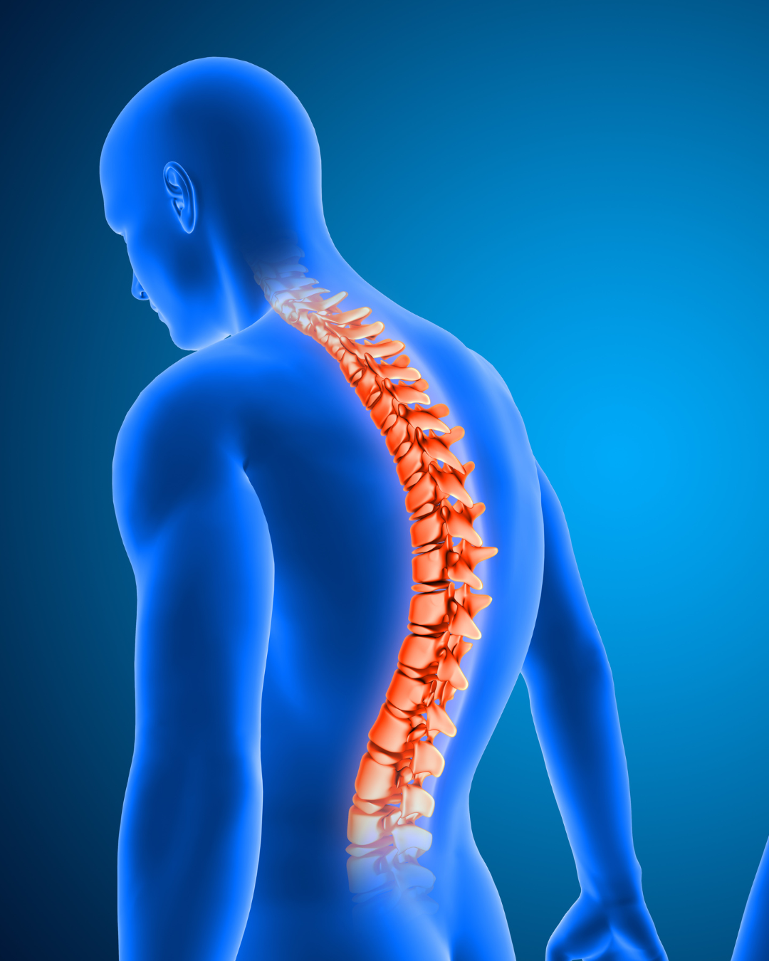 Cirugía de escoliosis en adultos