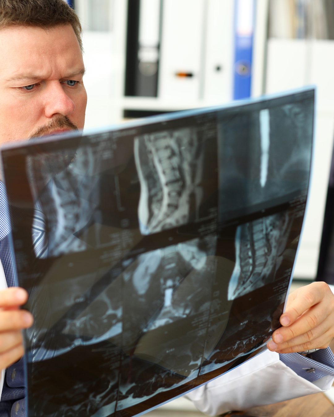 Cirugía descompresiva lumbar