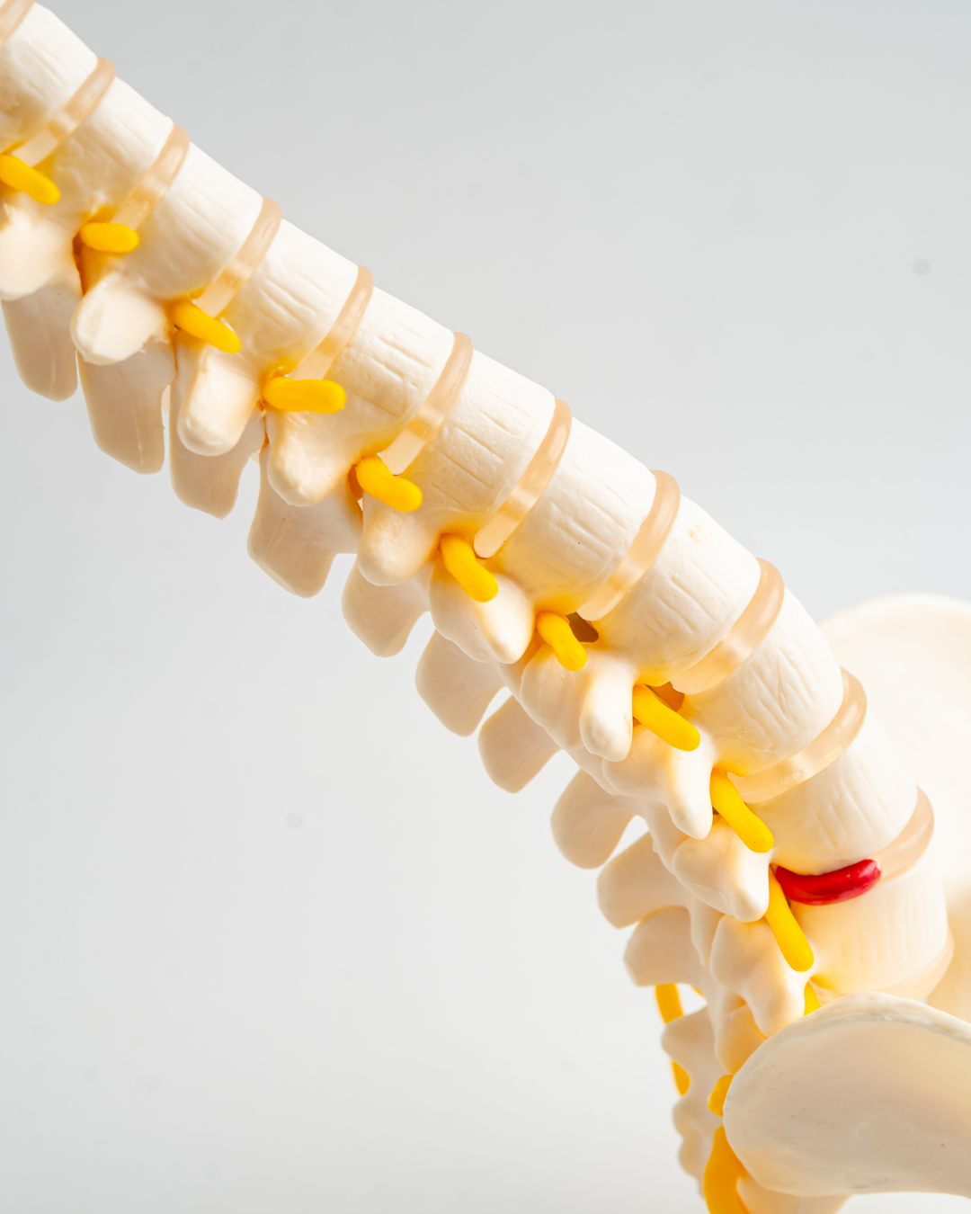 Discoidectomía lumbar precio
