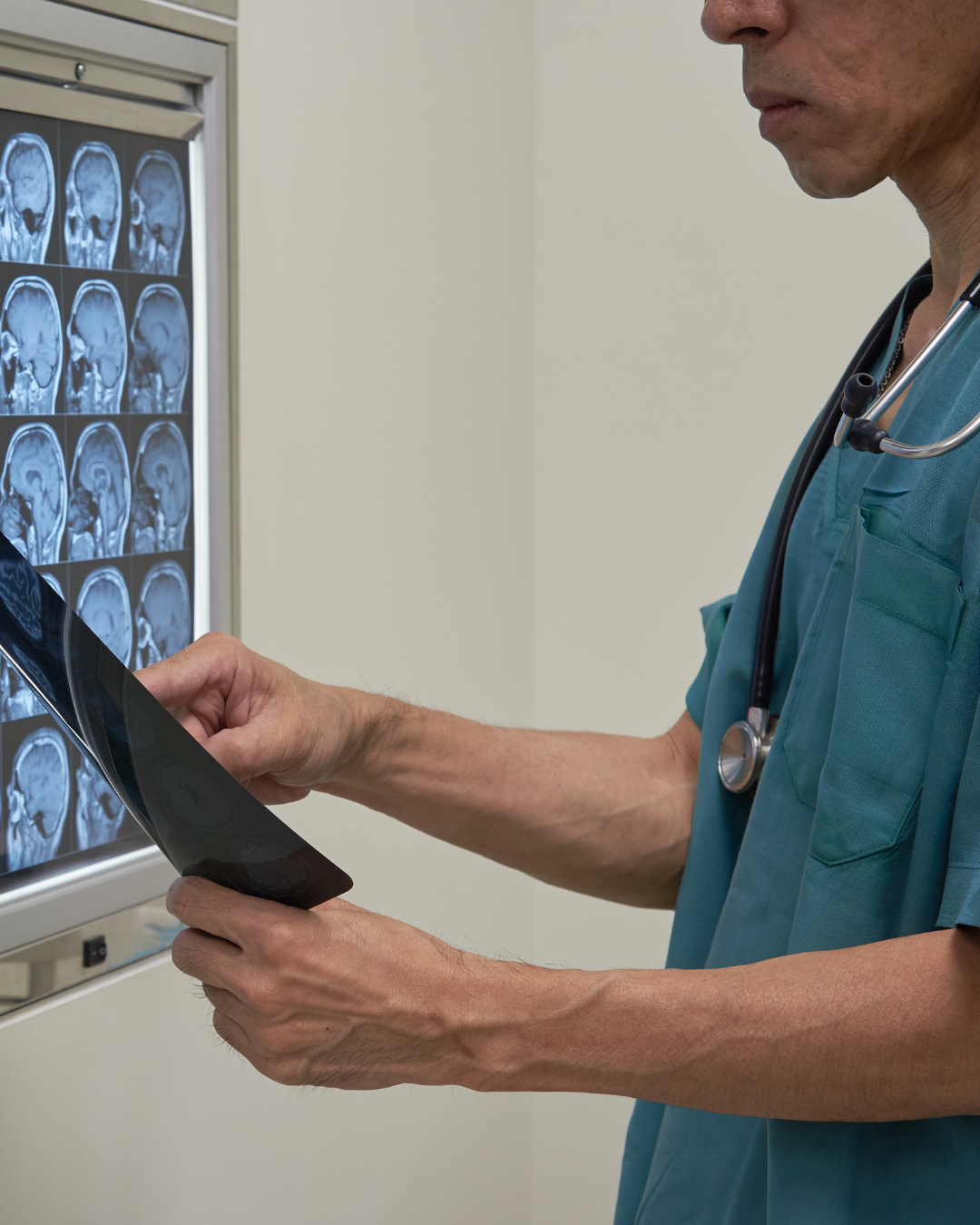 Neurocirujano en Puebla especialista en columna